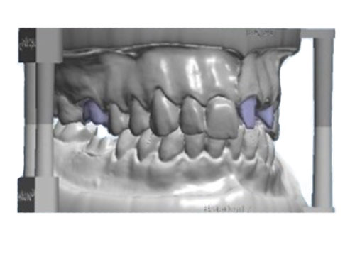 Tooth Questions